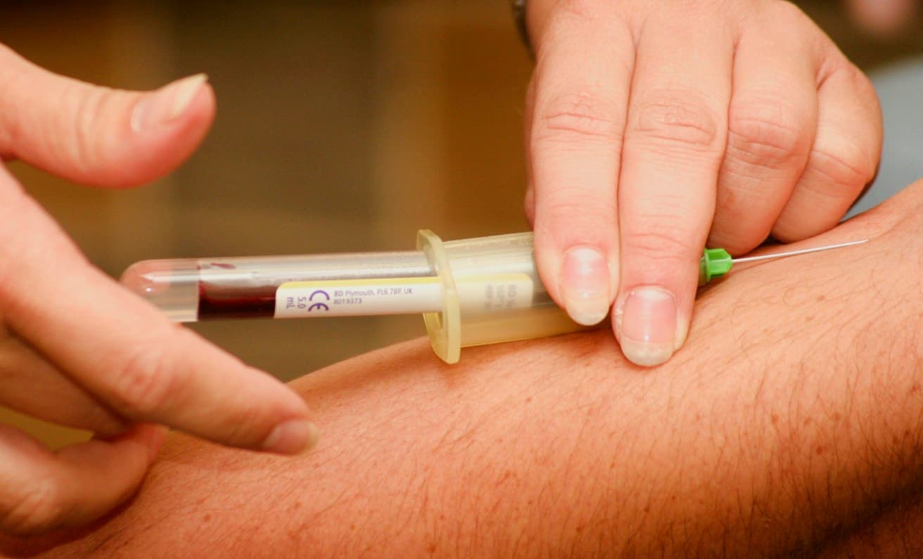 Jornada gratuita de detección temprana de cáncer de próstata en San Miguelito